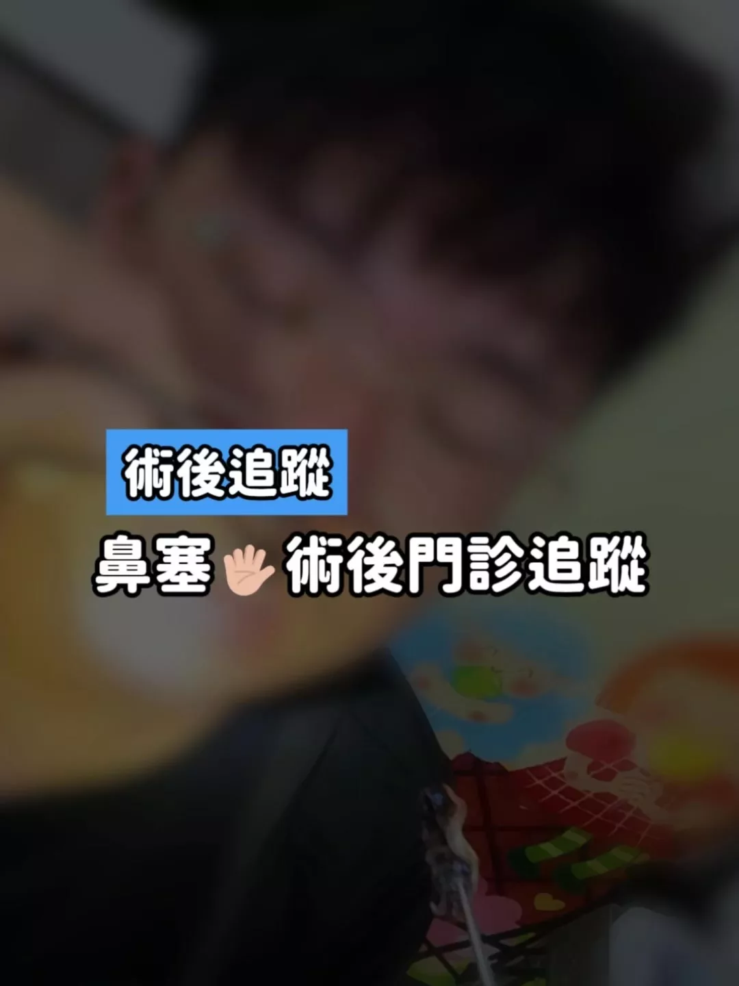 鼻塞手術門診追蹤